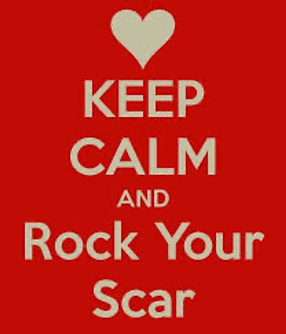 <p>Do you have a scar for surgery? How do you feel about your scar?</p>