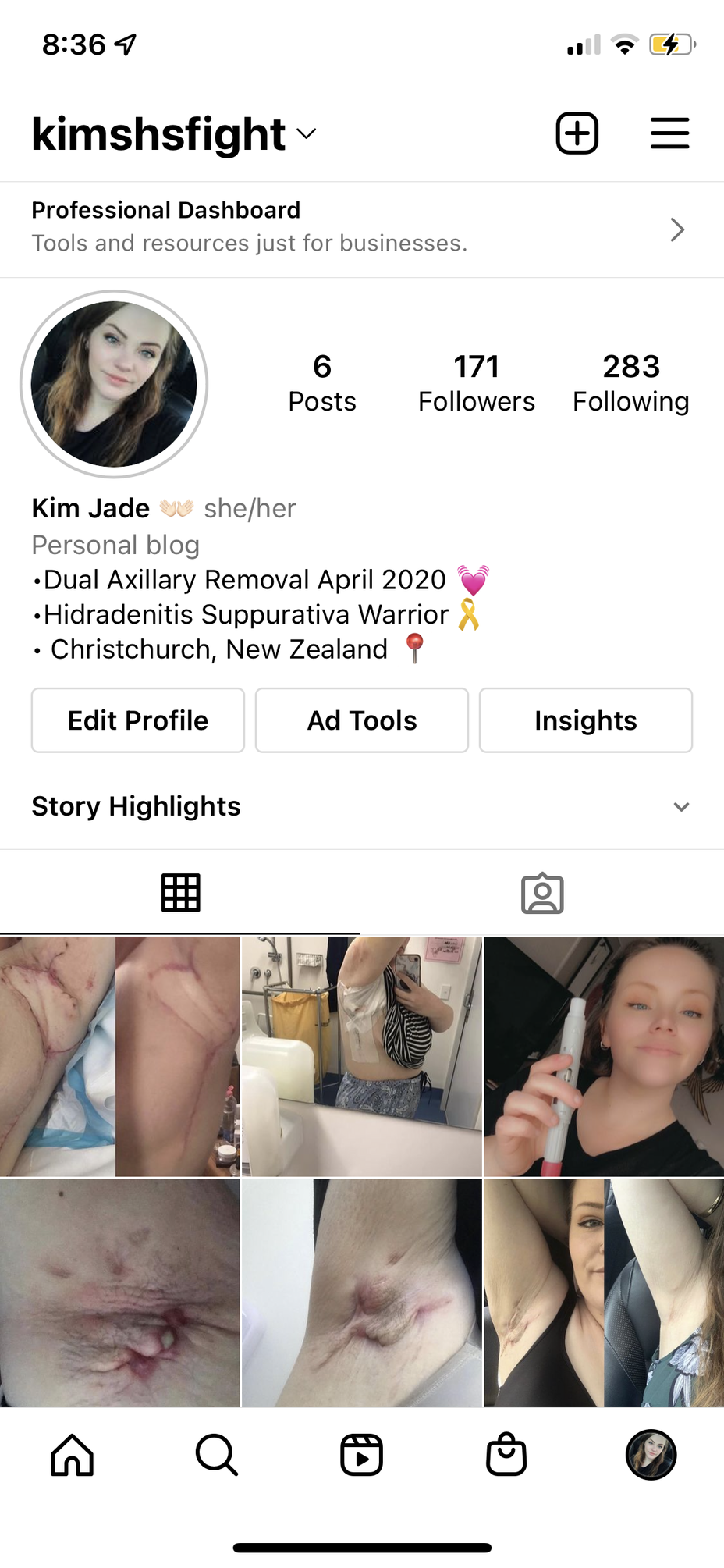 <p>Anyone have a Instagram documenting their illness? I’m looking for people to follow on mine. <a class="tm-topic-link mighty-topic" title="Hidradenitis Suppurativa" href="/topic/hidradenitis-suppurativa/" data-id="5b23ce8800553f33fe994299" data-name="Hidradenitis Suppurativa" aria-label="hashtag Hidradenitis Suppurativa">#HidradenitisSuppurativa</a>  <a class="tm-topic-link mighty-topic" title="Chronic Illness" href="/topic/chronic-illness/" data-id="5b23ce6f00553f33fe98fe39" data-name="Chronic Illness" aria-label="hashtag Chronic Illness">#ChronicIllness</a> </p>