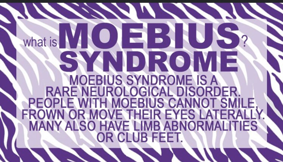 <p>Do you know much about <a class="tm-topic-link mighty-topic" title="Moebius Syndrome" href="/topic/moebius-syndrome/" data-id="5b23ce9d00553f33fe997ff7" data-name="Moebius Syndrome" aria-label="hashtag Moebius Syndrome">#MoebiusSyndrome</a></p>