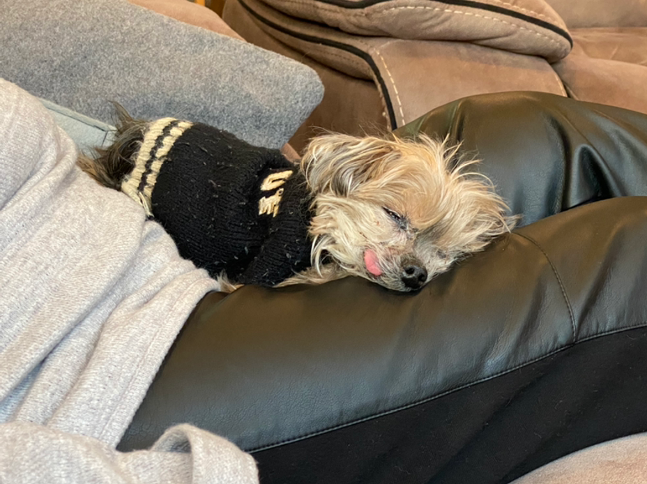 clubfeet Signs, Symptoms, Support