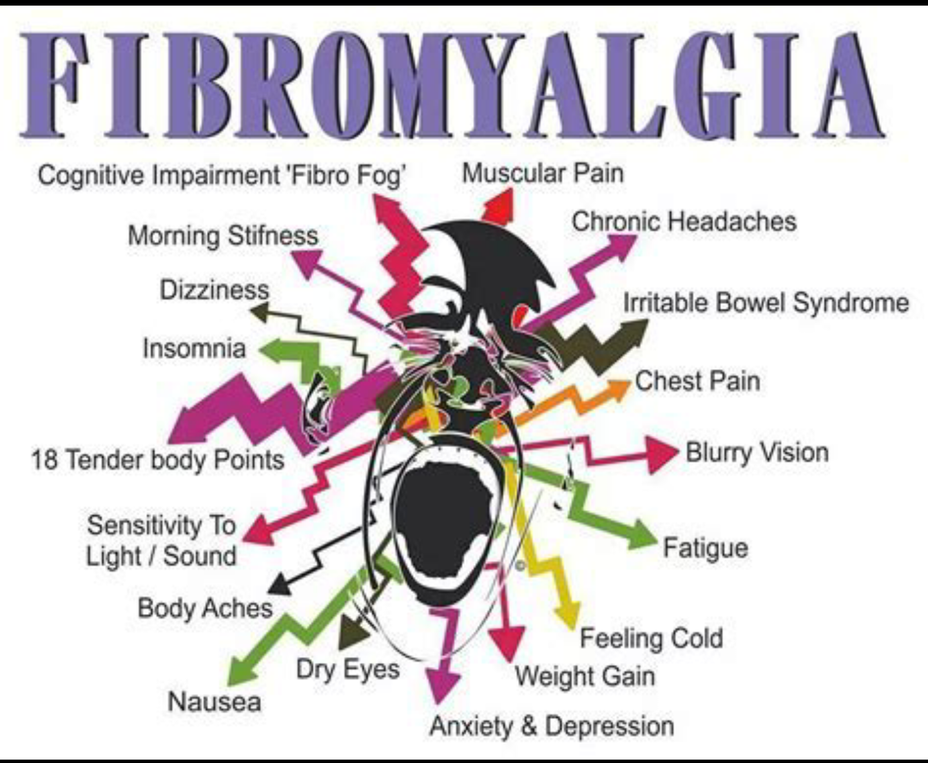 <p><a class="tm-topic-link mighty-topic" title="Fibromyalgia" href="/topic/fibromyalgia/" data-id="5b23ce7f00553f33fe992ab1" data-name="Fibromyalgia" aria-label="hashtag Fibromyalgia">#Fibromyalgia</a>  <a class="tm-topic-link ugc-topic" title="fibroflare" href="/topic/fibroflare/" data-id="5bd04aa0d540b100ac3a7b27" data-name="fibroflare" aria-label="hashtag fibroflare">#fibroflare</a>  <a class="tm-topic-link ugc-topic" title="nosleep" href="/topic/nosleep/" data-id="5bcd9ac7d540b100acfec714" data-name="nosleep" aria-label="hashtag nosleep">#nosleep</a>  <a class="tm-topic-link ugc-topic" title="brutal" href="/topic/brutal/" data-id="6025060d4ed74d010484ce80" data-name="brutal" aria-label="hashtag brutal">#brutal</a>  <a class="tm-topic-link ugc-topic" title="pain" href="/topic/pain/" data-id="5b23cea600553f33fe999848" data-name="pain" aria-label="hashtag pain">#Pain</a>  <a class="tm-topic-link mighty-topic" title="Chronic Pain" href="/topic/chronic-pain/" data-id="5b23ce6f00553f33fe98ff5b" data-name="Chronic Pain" aria-label="hashtag Chronic Pain">#ChronicPain</a> </p>