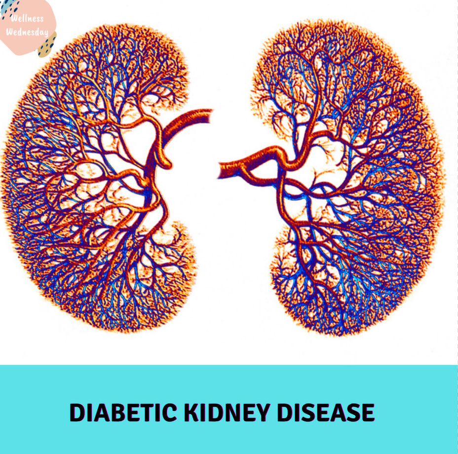 <p>Wellness Wednesday: Diabetic <a href="https://themighty.com/topic/kidney-disease/?label=Kidney Disease" class="tm-embed-link  tm-autolink health-map" data-id="5b23ce9200553f33fe9960e0" data-name="Kidney Disease" title="Kidney Disease" target="_blank">Kidney Disease</a></p>