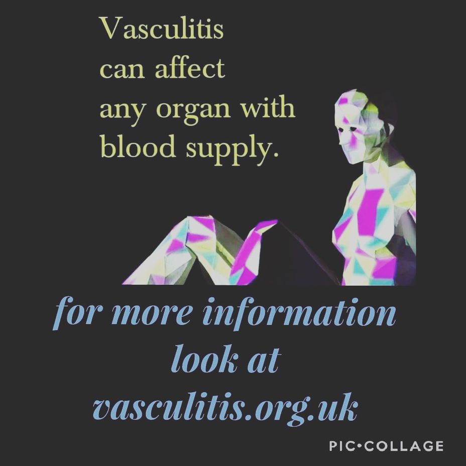 <p><a href="https://themighty.com/topic/vasculitis/?label=Vasculitis" class="tm-embed-link  tm-autolink health-map" data-id="5b23cec600553f33fe99f215" data-name="Vasculitis" title="Vasculitis" target="_blank">Vasculitis</a> awareness month</p>