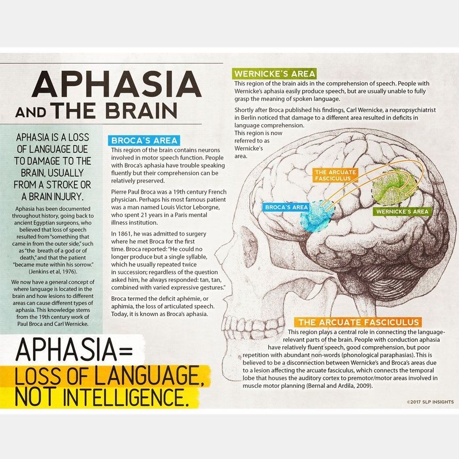 <p><a class="tm-topic-link mighty-topic" title="Acquired Epileptiform Aphasia" href="/topic/acquired-epileptiform-aphasia/" data-id="5b23ce5700553f33fe98c229" data-name="Acquired Epileptiform Aphasia" aria-label="hashtag Acquired Epileptiform Aphasia">#AcquiredEpileptiformAphasia</a>  <a href="https://themighty.com/topic/aphasia/?label=Aphasia" class="tm-embed-link  tm-autolink health-map" data-id="5b23ce6000553f33fe98d329" data-name="Aphasia" title="Aphasia" target="_blank">Aphasia</a></p>